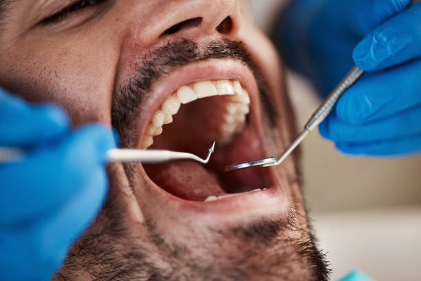 Best Emergency Broken Tooth Repair in Roberts, WI